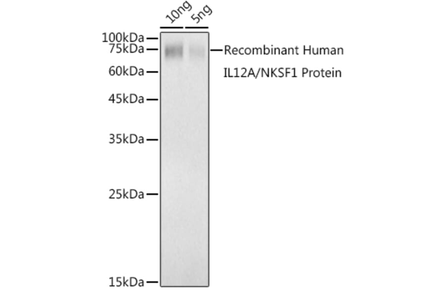 Western Blot - Anti-IL-12A Antibody (A306535) - Antibodies.com