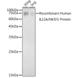 Western Blot - Anti-IL-12A Antibody (A306535) - Antibodies.com