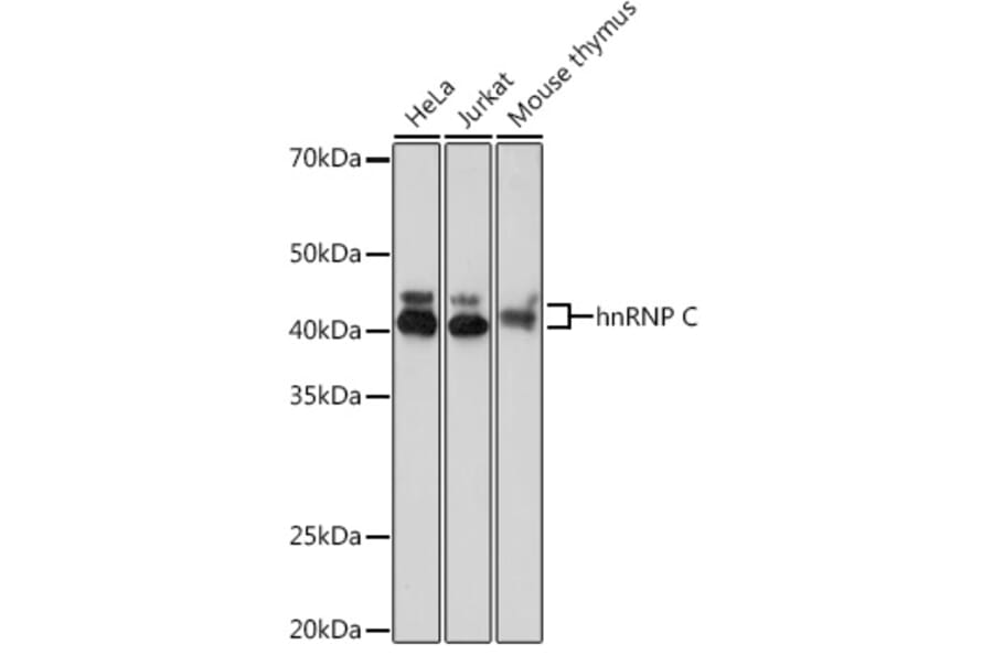 Western Blot - Anti-hnRNP C1/C2/HNRNPC Antibody [ARC1366] (A306536) - Antibodies.com
