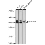 Western Blot - Anti-hnRNP C1/C2/HNRNPC Antibody [ARC1366] (A306536) - Antibodies.com