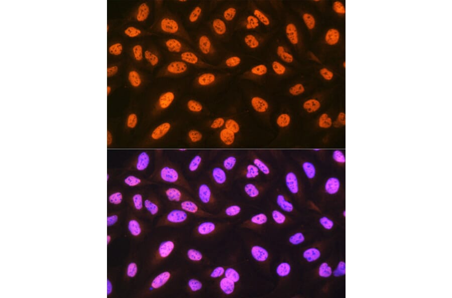 Immunofluorescence - Anti-hnRNP C1/C2/HNRNPC Antibody [ARC1366] (A306536) - Antibodies.com