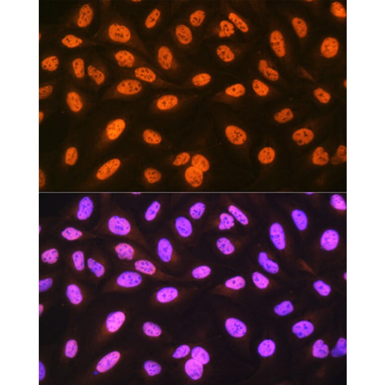 Immunofluorescence - Anti-hnRNP C1/C2/HNRNPC Antibody [ARC1366] (A306536) - Antibodies.com
