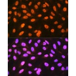 Immunofluorescence - Anti-hnRNP C1/C2/HNRNPC Antibody [ARC1366] (A306536) - Antibodies.com