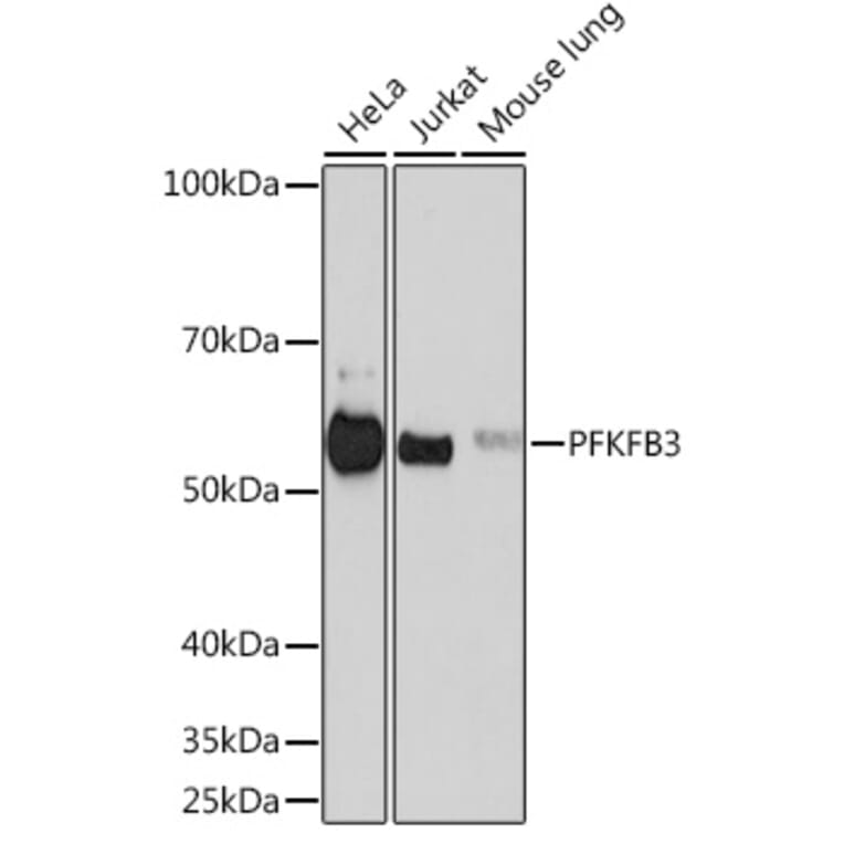 Western Blot - Anti-PFKFB3 Antibody [ARC50569] (A306538) - Antibodies.com