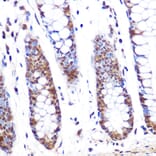 Immunohistochemistry - Anti-PFKFB3 Antibody (A306538) - Antibodies.com