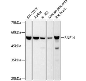 Western Blot - Anti-RNF14 Antibody [ARC2884] (A306540) - Antibodies.com