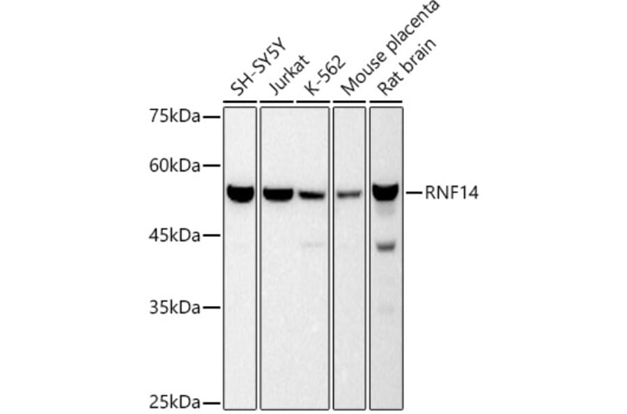 Western Blot - Anti-RNF14 Antibody [ARC2884] (A306540) - Antibodies.com
