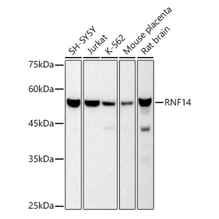 Western Blot - Anti-RNF14 Antibody [ARC2884] (A306540) - Antibodies.com