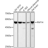 Western Blot - Anti-RNF14 Antibody [ARC2884] (A306540) - Antibodies.com
