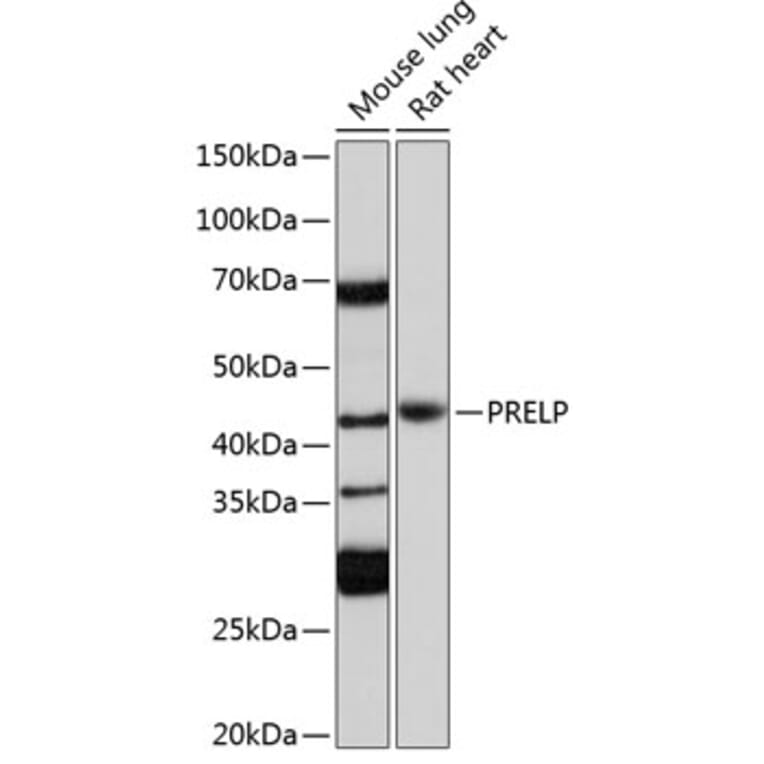 Western Blot - Anti-PRELP Antibody (A306541) - Antibodies.com