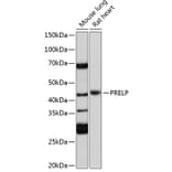 Western Blot - Anti-PRELP Antibody (A306541) - Antibodies.com