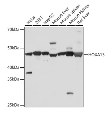 Western Blot - Anti-HOXA13 Antibody [ARC1636] (A306542) - Antibodies.com