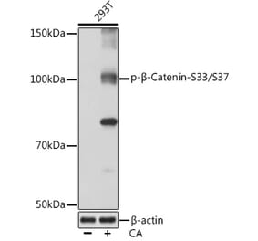 Western Blot - Anti-beta Catenin (phospho Ser33 + Ser37) Antibody (A306543) - Antibodies.com