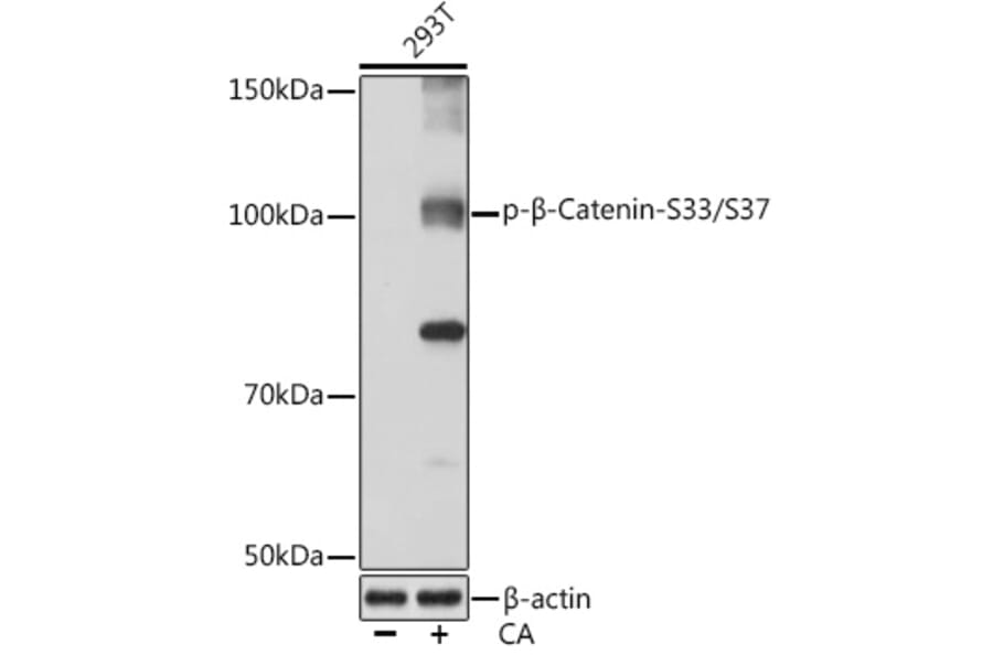 Western Blot - Anti-beta Catenin (phospho Ser33 + Ser37) Antibody (A306543) - Antibodies.com