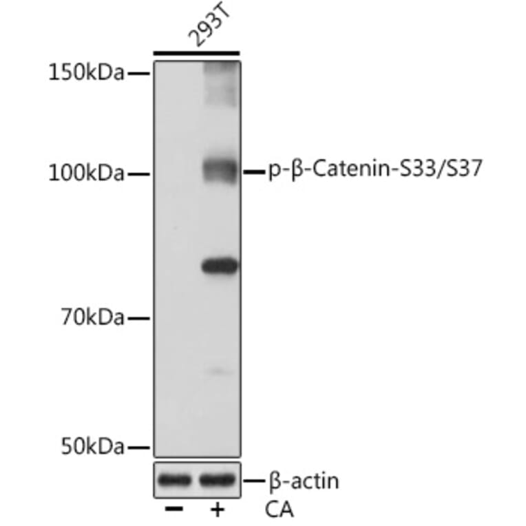 Western Blot - Anti-beta Catenin (phospho Ser33 + Ser37) Antibody (A306543) - Antibodies.com