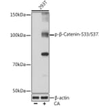 Western Blot - Anti-beta Catenin (phospho Ser33 + Ser37) Antibody (A306543) - Antibodies.com