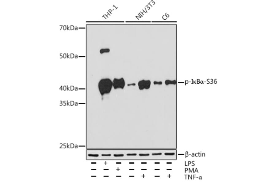 Western Blot - Anti-IKB alpha (phospho Ser36) Antibody [ARC1543] (A306544) - Antibodies.com