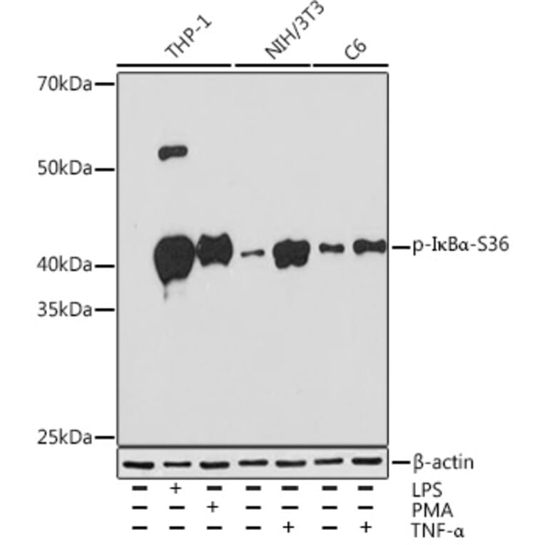 Western Blot - Anti-IKB alpha (phospho Ser36) Antibody [ARC1543] (A306544) - Antibodies.com