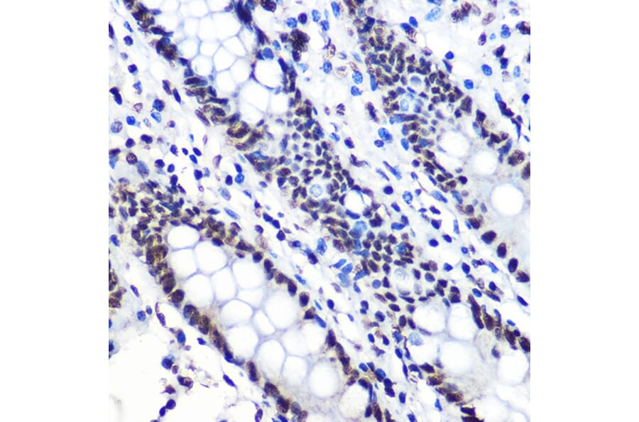 Immunohistochemistry - Anti-IKB alpha (phospho Ser36) Antibody [ARC1543] (A306544) - Antibodies.com
