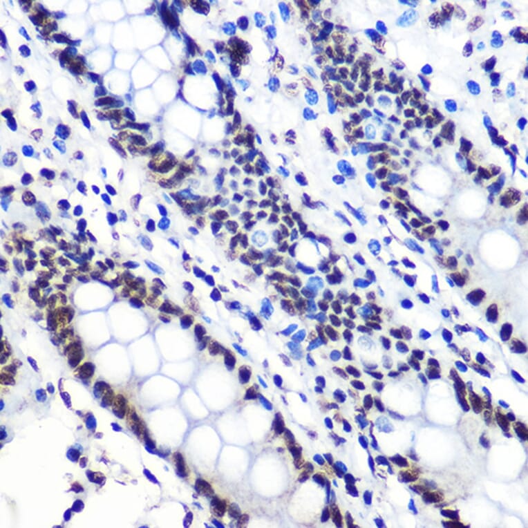 Immunohistochemistry - Anti-IKB alpha (phospho Ser36) Antibody [ARC1543] (A306544) - Antibodies.com