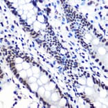 Immunohistochemistry - Anti-IKB alpha (phospho Ser36) Antibody [ARC1543] (A306544) - Antibodies.com