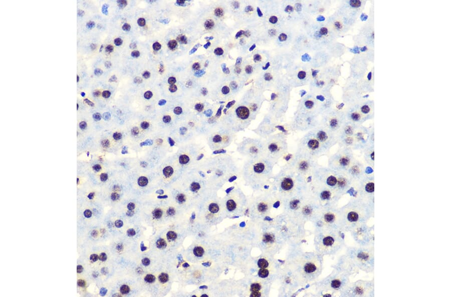 Immunohistochemistry - Anti-IKB alpha (phospho Ser36) Antibody [ARC1543] (A306544) - Antibodies.com