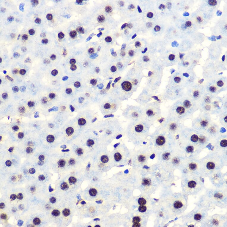 Immunohistochemistry - Anti-IKB alpha (phospho Ser36) Antibody [ARC1543] (A306544) - Antibodies.com