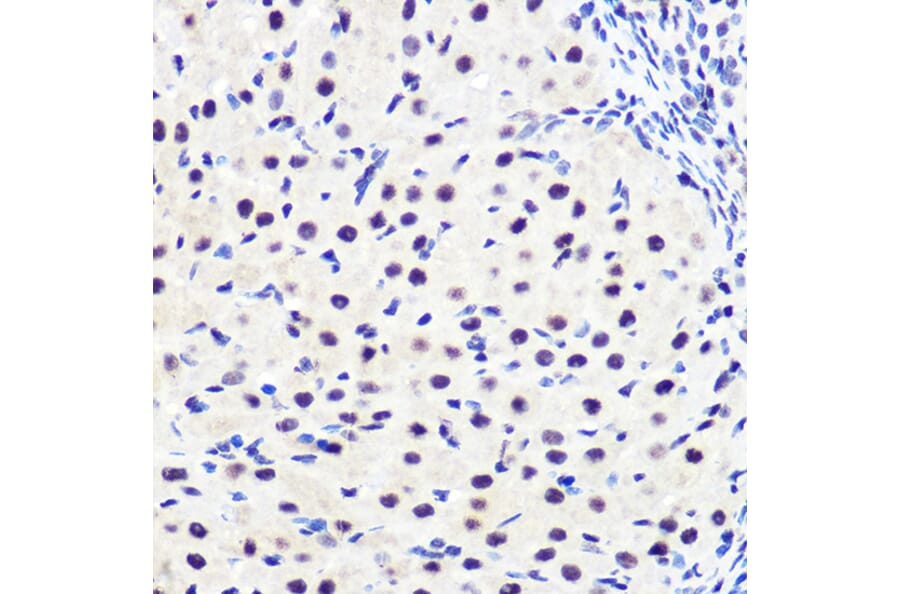 Immunohistochemistry - Anti-IKB alpha (phospho Ser36) Antibody [ARC1543] (A306544) - Antibodies.com
