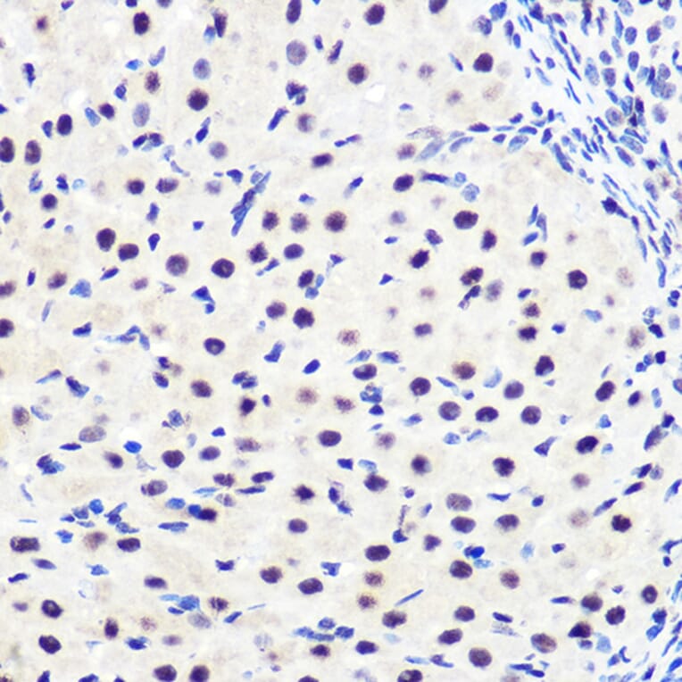 Immunohistochemistry - Anti-IKB alpha (phospho Ser36) Antibody [ARC1543] (A306544) - Antibodies.com