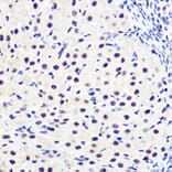 Immunohistochemistry - Anti-IKB alpha (phospho Ser36) Antibody [ARC1543] (A306544) - Antibodies.com