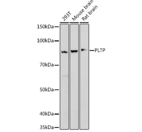 Western Blot - Anti-PLTP Antibody [ARC1676] (A306546) - Antibodies.com