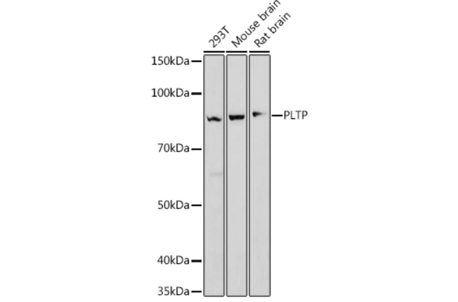 Western Blot - Anti-PLTP Antibody [ARC1676] (A306546) - Antibodies.com