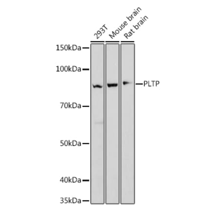 Western Blot - Anti-PLTP Antibody [ARC1676] (A306546) - Antibodies.com