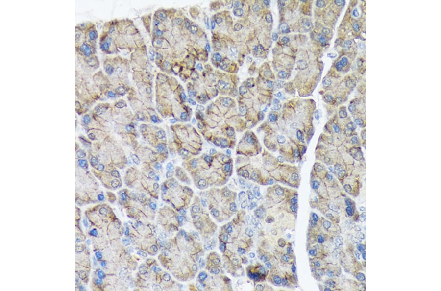 Immunohistochemistry - Anti-PLTP Antibody [ARC1676] (A306546) - Antibodies.com