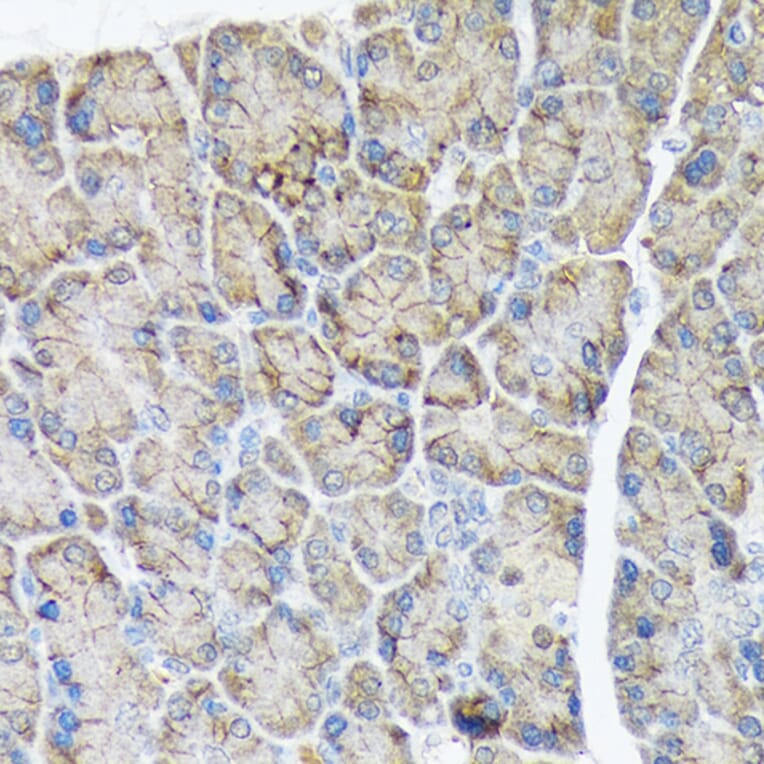 Immunohistochemistry - Anti-PLTP Antibody [ARC1676] (A306546) - Antibodies.com
