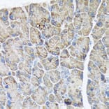 Immunohistochemistry - Anti-PLTP Antibody [ARC1676] (A306546) - Antibodies.com