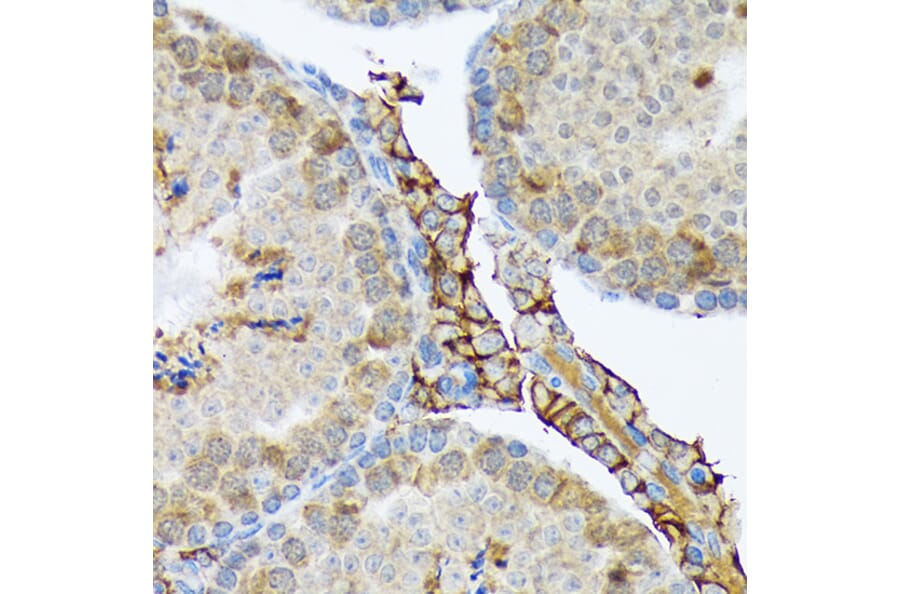Immunohistochemistry - Anti-PLTP Antibody [ARC1676] (A306546) - Antibodies.com