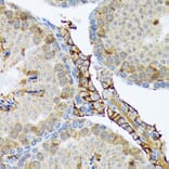Immunohistochemistry - Anti-PLTP Antibody [ARC1676] (A306546) - Antibodies.com
