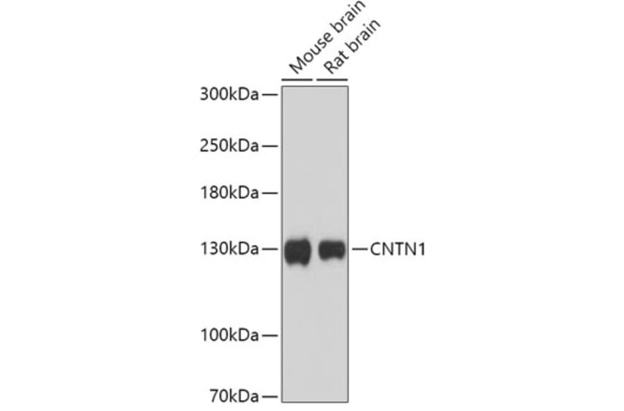 Western Blot - Anti-Contactin 1 Antibody (A306547) - Antibodies.com