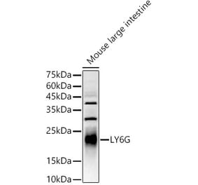 Western Blot - Anti-Ly6g Antibody (A306549) - Antibodies.com