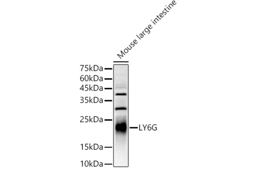 Western Blot - Anti-Ly6g Antibody (A306549) - Antibodies.com