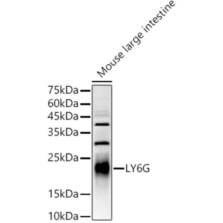 Western Blot - Anti-Ly6g Antibody (A306549) - Antibodies.com