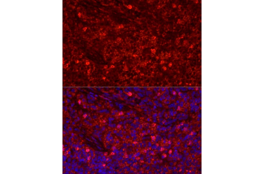 Immunofluorescence - Anti-Ly6g Antibody (A306549) - Antibodies.com