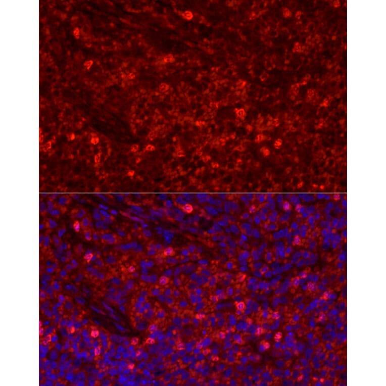 Immunofluorescence - Anti-Ly6g Antibody (A306549) - Antibodies.com