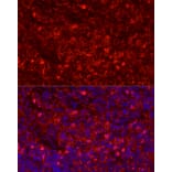 Immunofluorescence - Anti-Ly6g Antibody (A306549) - Antibodies.com