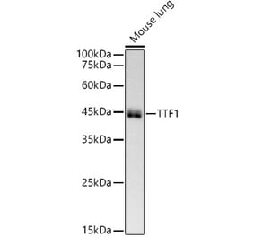 Western Blot - Anti-TTF1 Antibody [ARC51284] (A306550) - Antibodies.com