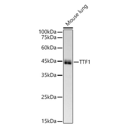 Western Blot - Anti-TTF1 Antibody [ARC51284] (A306550) - Antibodies.com