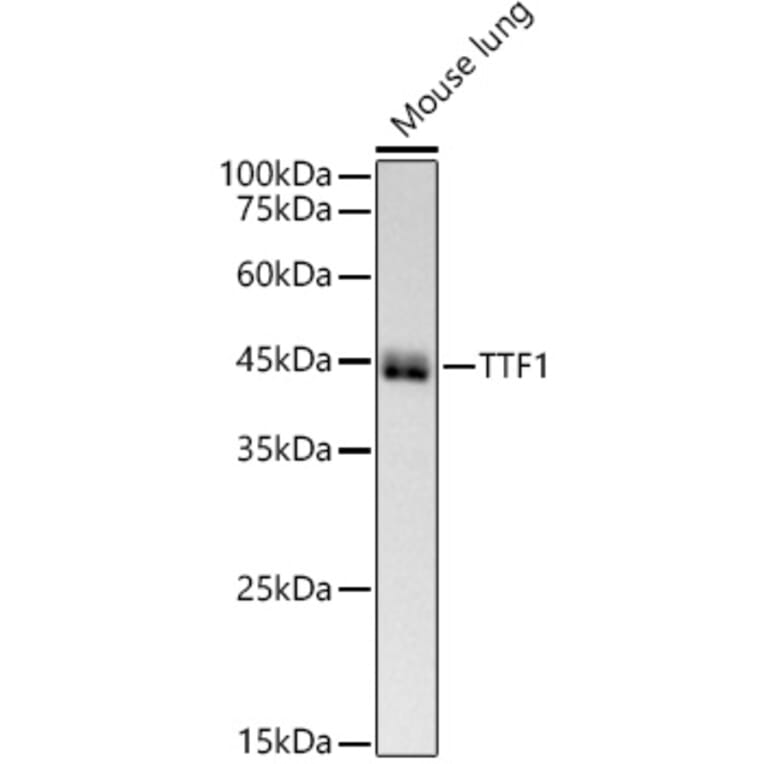 Western Blot - Anti-TTF1 Antibody [ARC51284] (A306550) - Antibodies.com