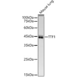 Western Blot - Anti-TTF1 Antibody [ARC51284] (A306550) - Antibodies.com