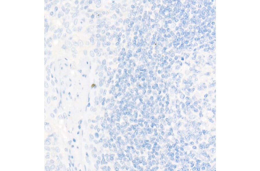 Immunohistochemistry - Anti-TTF1 Antibody [ARC51284] (A306550) - Antibodies.com